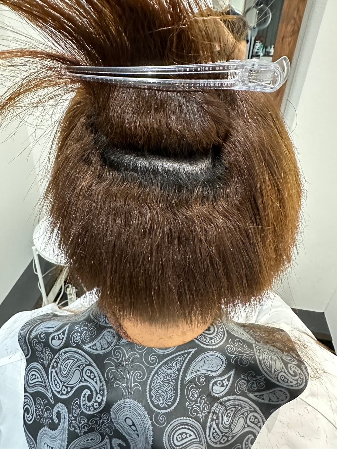 施術前